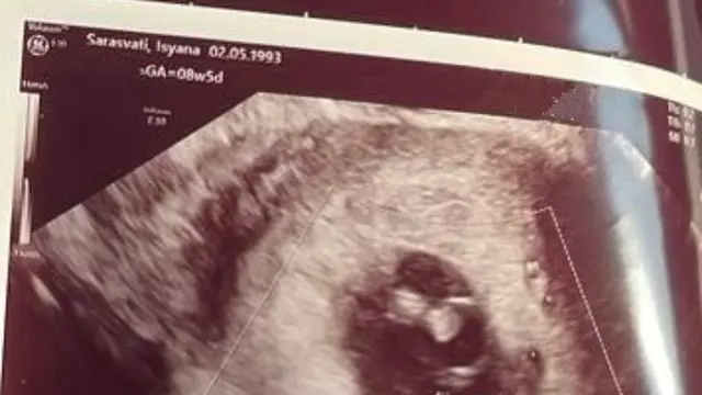 Isyana Sarasvati kehilangan calon janin