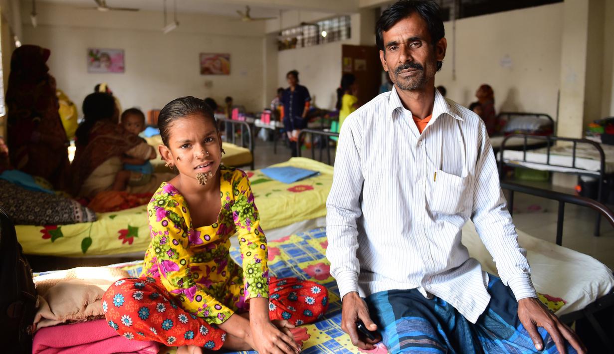 Sahana Khatun ditemani ayahnya, Mohammad Shahjahan, saat menjalani perawatan di sebuah rumah sakit di Dhaka, Bangladesh, 30 Januari 2017. Dokter menyimpulkan, Sahana mengalami kelainan yang sama langkanya dengan empat orang lain di seluruh dunia (STR/AFP)
