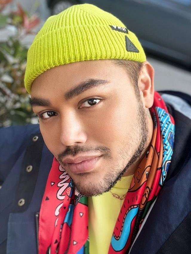 6 Potret Ivan Gunawan dengan Brewok Tebal dan Pipi Tirus, Banjir Pujian