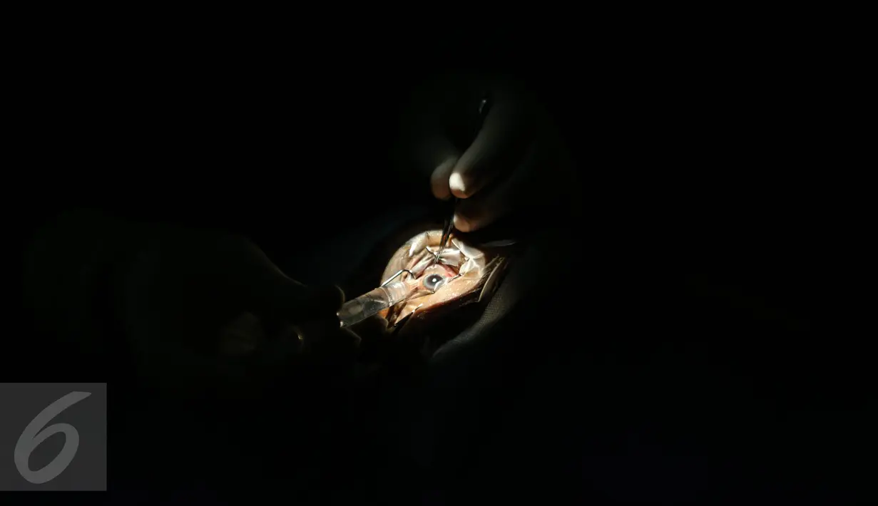 Dokter sedang melakukan operasi di Sakit Pusat Angkatan Darat (RSPAD) Gatot Subroto, Rabu (29/7/2015). Penderita katarak di Indonesia masih menempati posisi teratas di Asean. (Liputan6.com/Faizal Fanani)