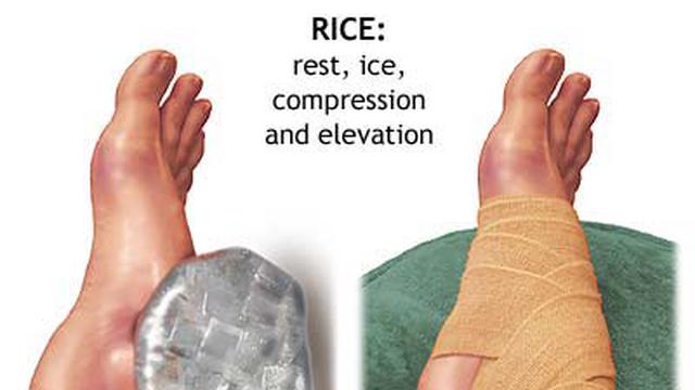 Saat cedera olahraga, Segera Kompres dengan Air Es