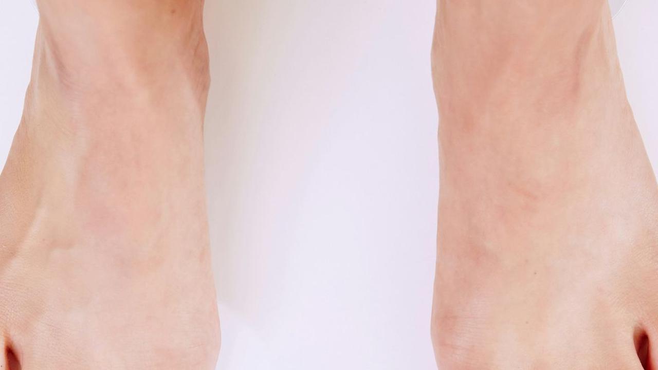 <b>Mengapa Diet Protein Ampuh untuk Menurunkan Berat Badan?</b>