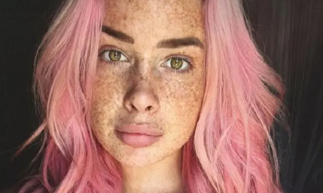 Peyton Smith, gadis cantik berusia 19 tahun ini memiliki banyak freckles kulit tubuhnya. (Foto: Instagram/@speckledgal)