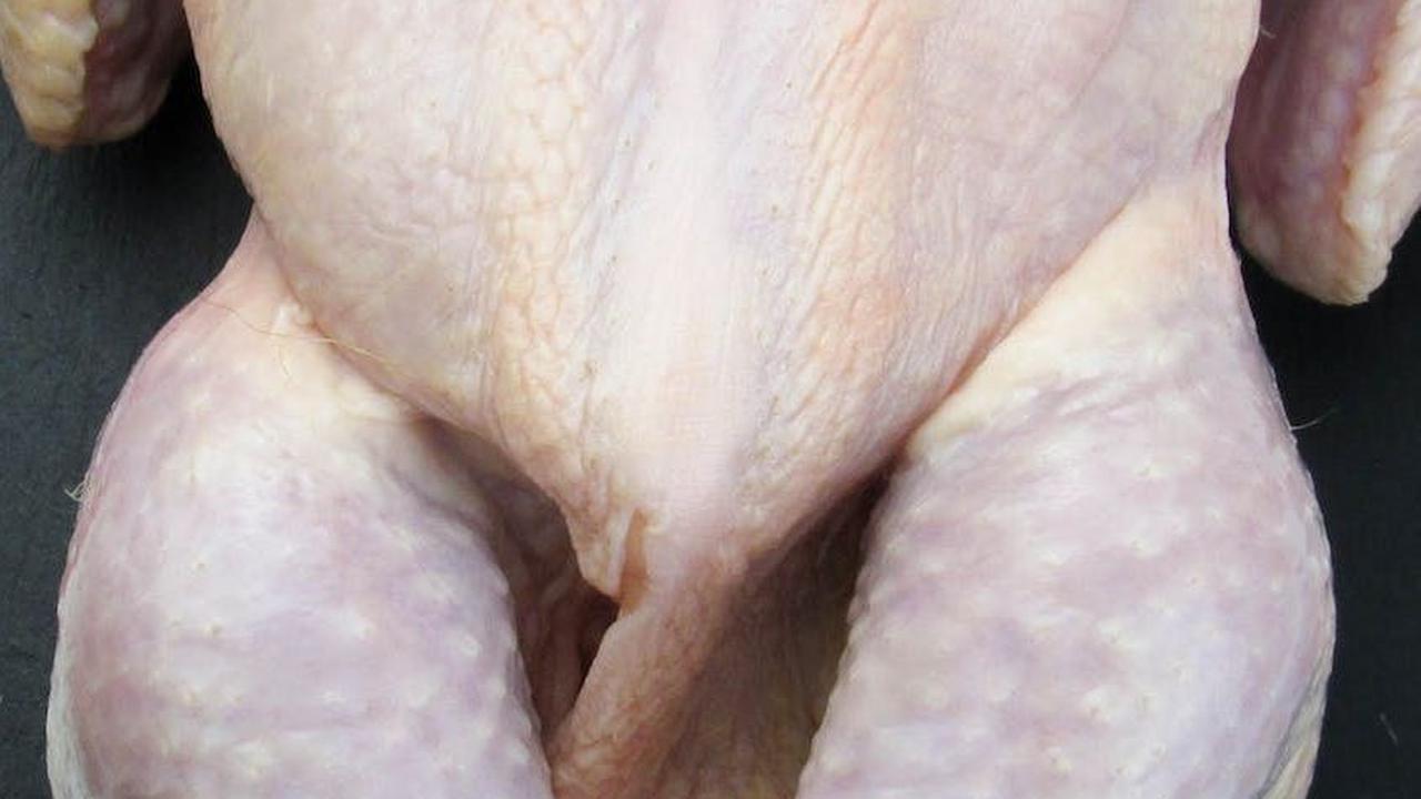 Peningkatan asupan makanan yang kaya zat besi: Pastikan anak mengonsumsi makanan yang kaya zat besi, seperti daging merah, ayam, kacang-kacangan, makanan laut, sayuran berdaun hijau, dan sereal yang diperkaya zat besi.