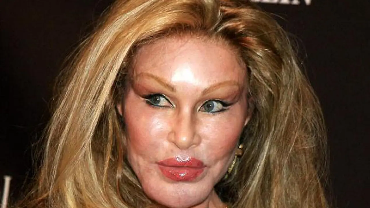 Jocelyn Wildenstein 1