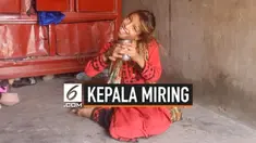 Seorang gadis asal Pakistan menderita kelainan otot yang menyebabkan kepalanya miring 90 derajat. Ia menunggu bantuan dari pemerintah untuk bisa menjalani operasi.