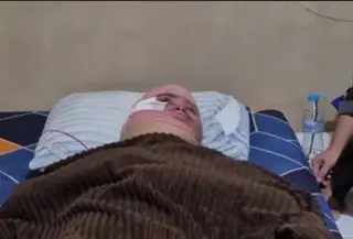 Korban Penyiraman Air Keras di Johar Baru (Tangkapan Layar Instagram @jakpus.terkini)