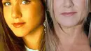 Aktris papan atas seperti Jennifer Aniston pun tak lepas dari operasi hidung loh! (REX/Shutterstock/HollywoodLife)
