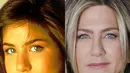 Aktris papan atas seperti Jennifer Aniston pun tak lepas dari operasi hidung loh! (REX/Shutterstock/HollywoodLife)