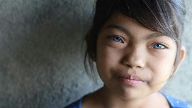 Seorang Gadis di Bali Memiliki Mata Biru yang Indah. (Sumber Foto: instagram @adi_py)