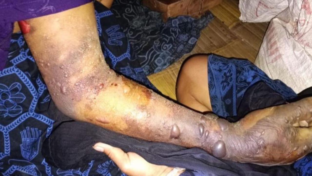 Serangan Ular Jenis Ini Gigit 28 Warga Badui, 2 Orang Meninggal