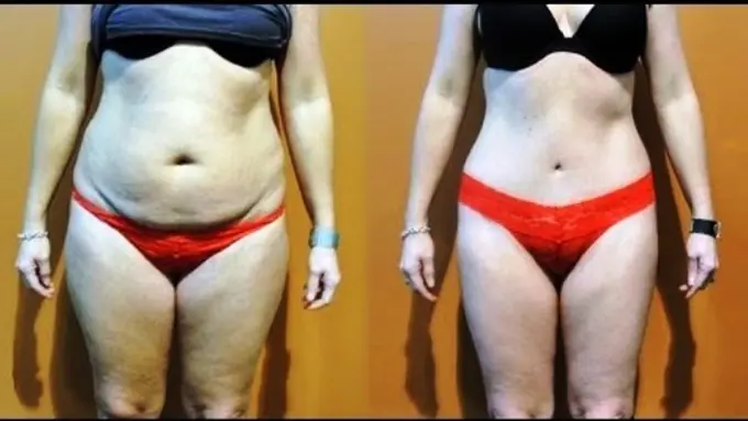 Tanpa Diet Berat Badan Turun 9 Kg dalam 21 Hari, Mau?