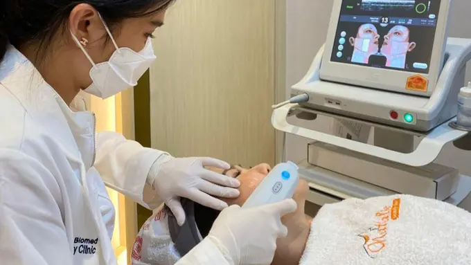 ULTHERAPY Treatment