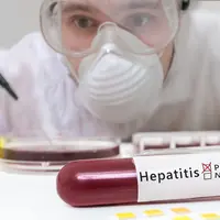 Ilustrasi penyakit hepatitis (sumber: iStock)