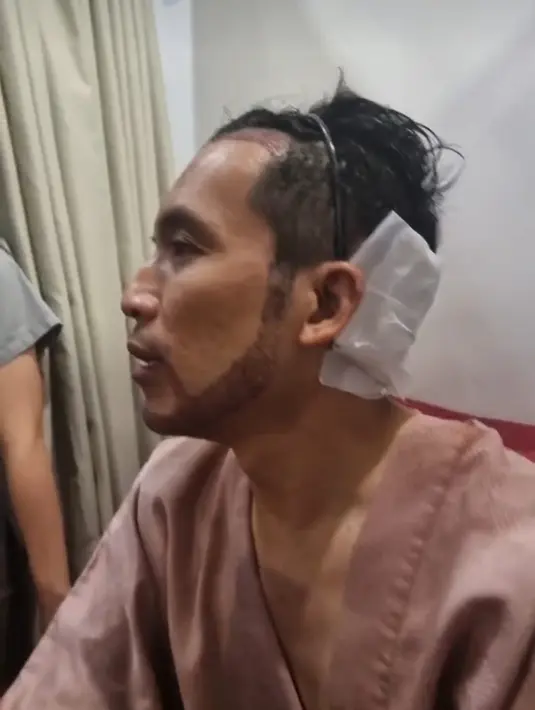 <p>Kata Desta, struktur rambutnya sudah mulai mundur sejak berpuluh tahun yang lalu. Itulah mengapa dahiya terlihat semakin lebar. (Foto: Instagram/ dr_tompi)</p>