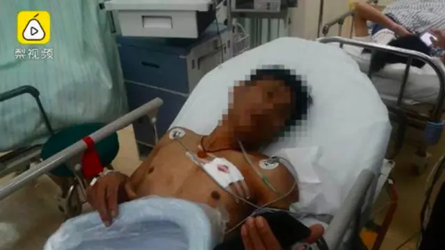 Dikira Hanya Gombalan, Wanita Tega Tusuk Pacar demi Dapatkan Jantungnya