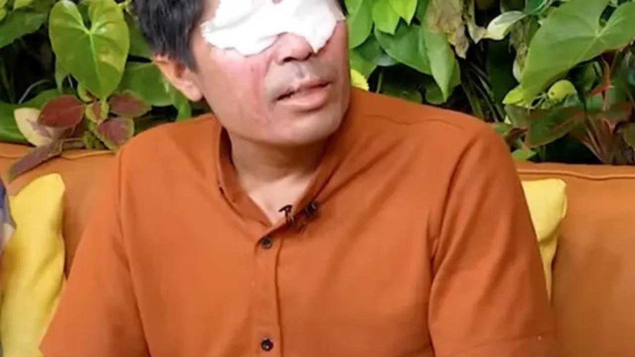 Uang Donasi Agus Salim Akhirnya Didonasikan untuk Korban Bencana Alam di Lewotobi, Ini Fakta di Baliknya