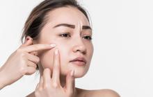 Dari Sabun hingga Tabir Surya, Simak Cara Cerdas Merawat Kulit Sensitif Berikut!