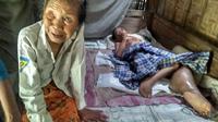 Tasripah terus berupaya menemani Karmijan. Ia akan duduk dan berbaring disitu sepanjang hari untuk siaga melayani putranya. Anggaran kemiskinan yang cukup besar tak menjangkaunya. (foto : Liputan6.com/felek/edhie prayitno ige)