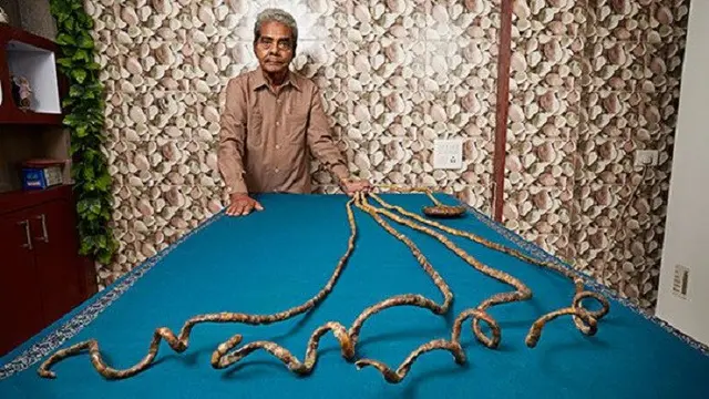 Sridhar pria dengan kuku panjang (Guinness World Records)