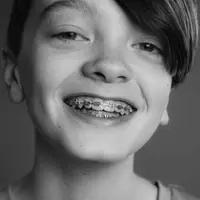 pemasangan kawat gigi dianggap mampu meningkatkan rasa percaya diri anak. Credits: unsplash.com by Jenna Tyson