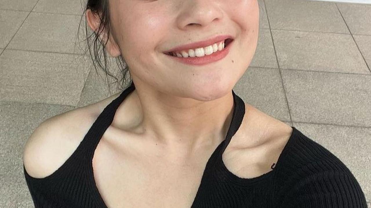 Bagian Tulang Dada yang Tampak Lebih Menonjol <br>