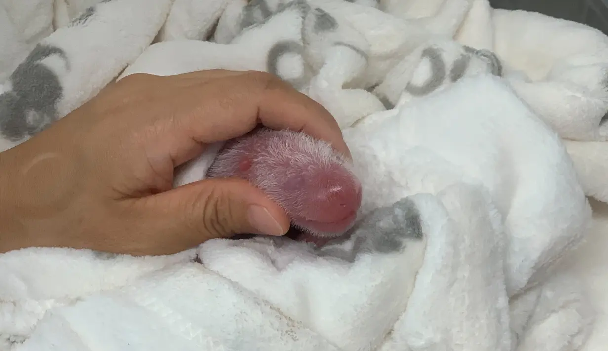 Salah satu bayi panda kembar yang baru lahir menjalani perawatan pertama mereka di Kebun Binatang Berlin, Senin (2/9/2019). Meng Meng, telah melahirkan dua ekor bayi pada Sabtu (31/8) malam dengan bobot masing-masing 136 gram dan 186 gram. (Zoo Berlin/Zoologischer Garten Berlin via AP)