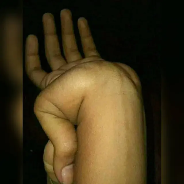 6 Potret Atraksi Jari Tangan, Cuma Melihat Bikin Kram