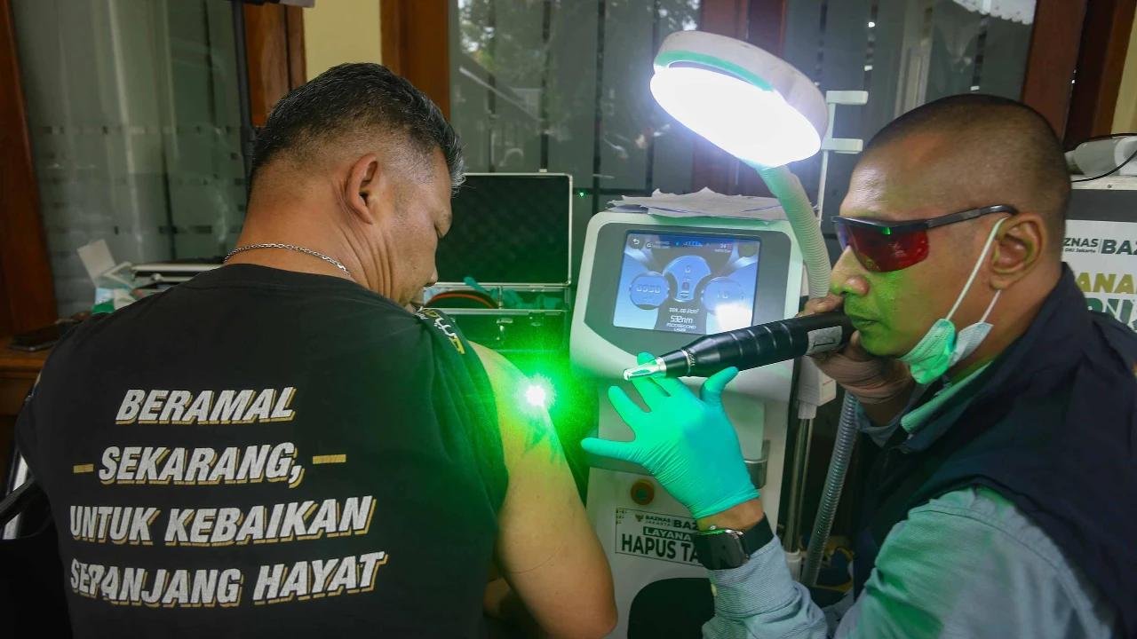FOTO: Layanan Hapus Tato Gratis Sambut Ramadhan di Jakarta