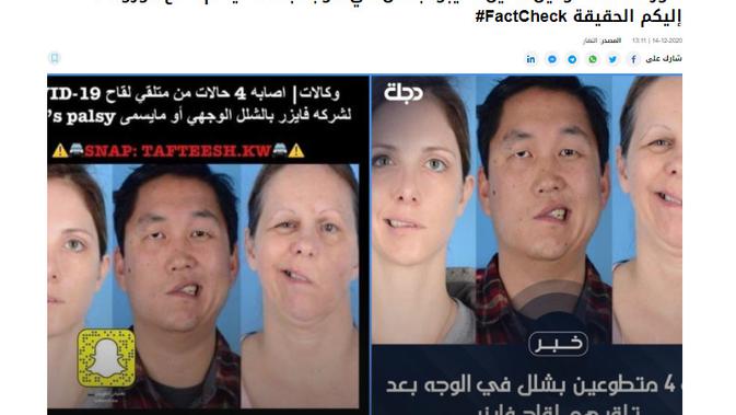 Cek Fakta Liputan6.com menelusuri klaim foto orang mengalami kelumpuhan wajah setelah divaksin corona