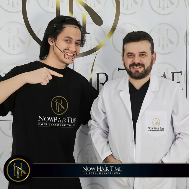 Potret Kevin Aprilio Jalani Transplantasi Rambut. (Sumber: Instagram/now.hairtime)