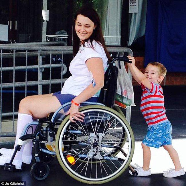 Karena infeksi pada punggung, Jo harus menggunakan kursi roda selama hidupnya | foto: copyright dailymail.co.uk
