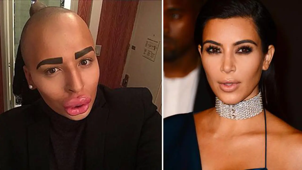 Top 5 Lifestyle: Pria Operasi Mirip Kim Kardashian Jadi Favorit