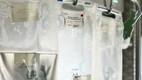 Keunggulan NaCl Dibanding Air Biasa untuk Membersihkan Luka Terbuka, Ini Alasannya