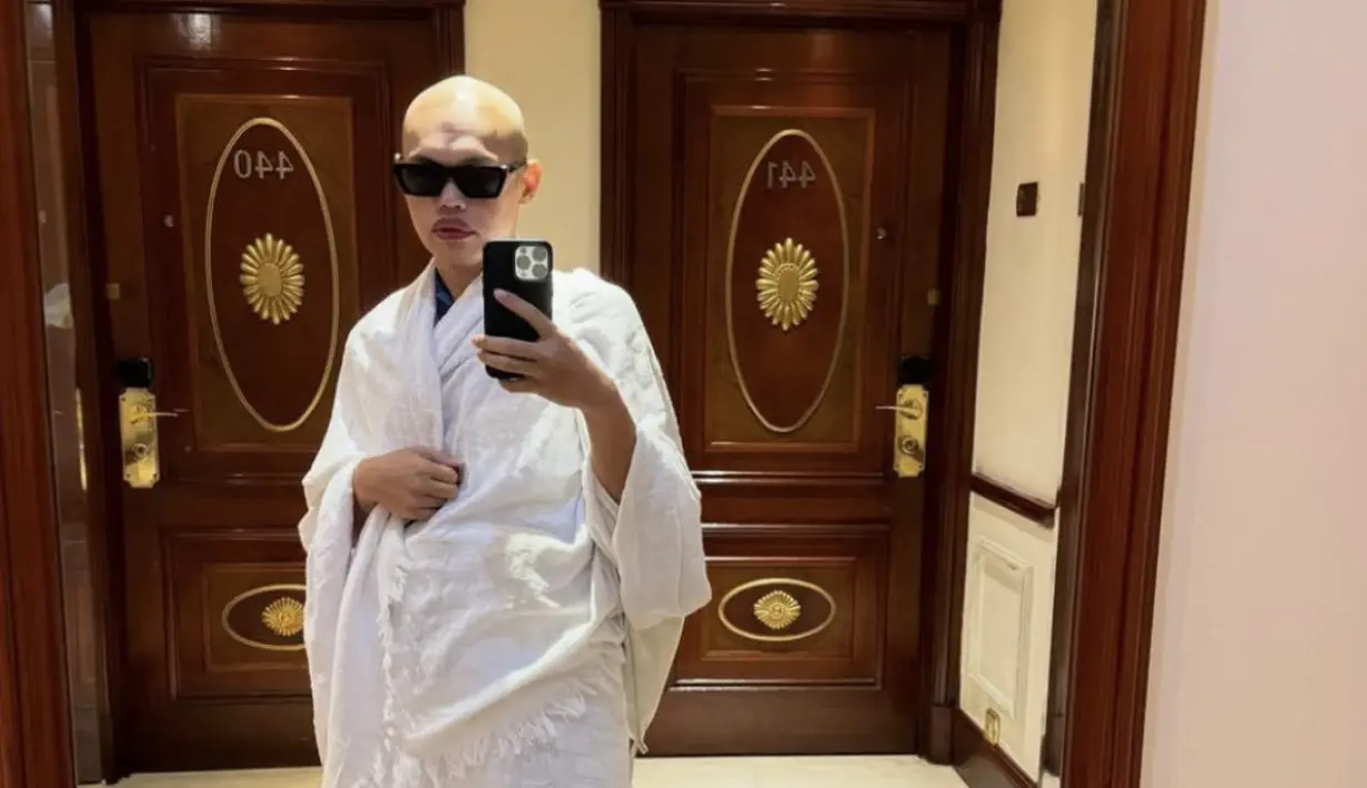 Gayanya tetap stylish dengan kaca mata hitam yang begitu statement.