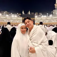 Tanpa riasan glamor, kulitnya tampak sehat dan bercahaya alami. Alis yang rapi, complexion yang terlihat bersih tanpa polesan tebal, serta bibir natural membuat wajahnya terlihat segar dan teduh. [@yurayunita].