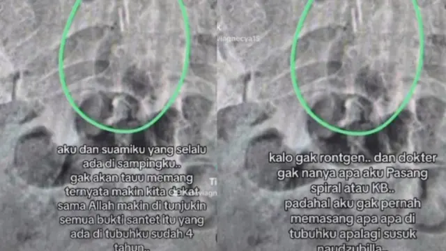 Stevie Agnecya meninggal (Instagram/steviagnecya)