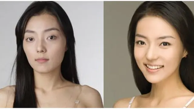 Foto: copyright kpsurgery.com