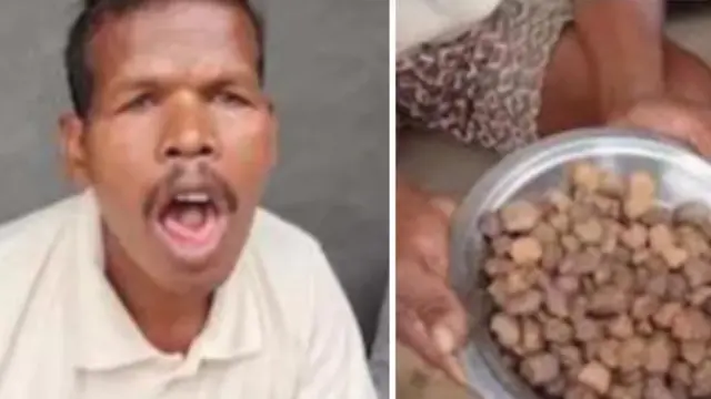 Pria Makan Batu Selama 12 Tahun