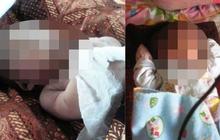 Derita bayi Husen meninggal akibat paru-paru lembap terkena asap