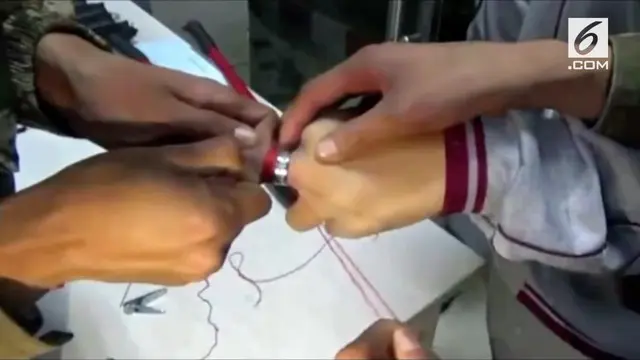 VIDEO: Cincin Kecil Nyangkut di Jari Selama 10 Jam
