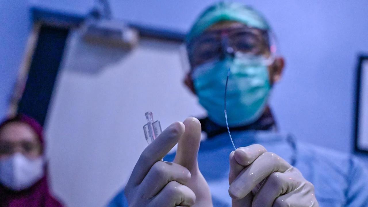 Dokter Ungkap Penyebab Serangan Jantung Kini Banyak Menyerang Usia Muda