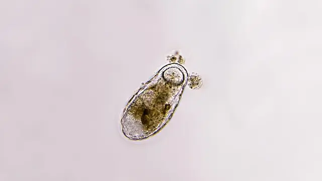 Amoeba dilihat dari mikroskop.