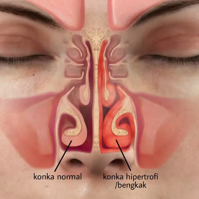 Konka Hidung