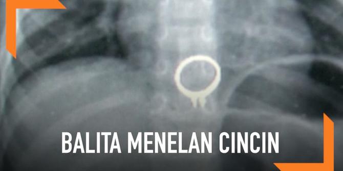 VIDEO: Balita Menelan Cincin Berlian Ibunya saat Bermain
