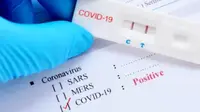 'New Normal', Warga NTT yang Bepergian Antarpulau Tak Perlu Kantongi Surat Rapid Test