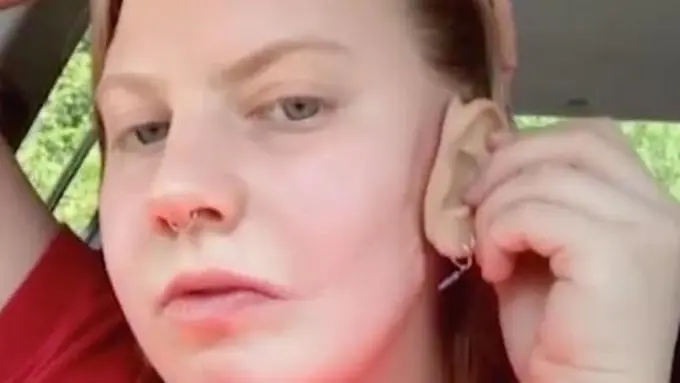 remaja putri yang hanya punya satu telinga/dok. Thelittlethings