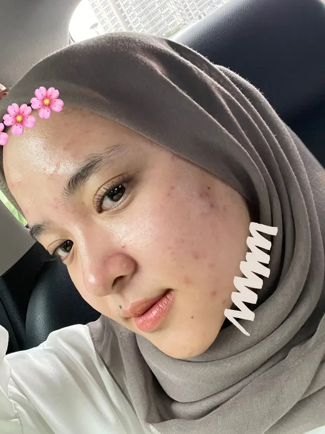 Nissa Sabyan Tanpa Makeup