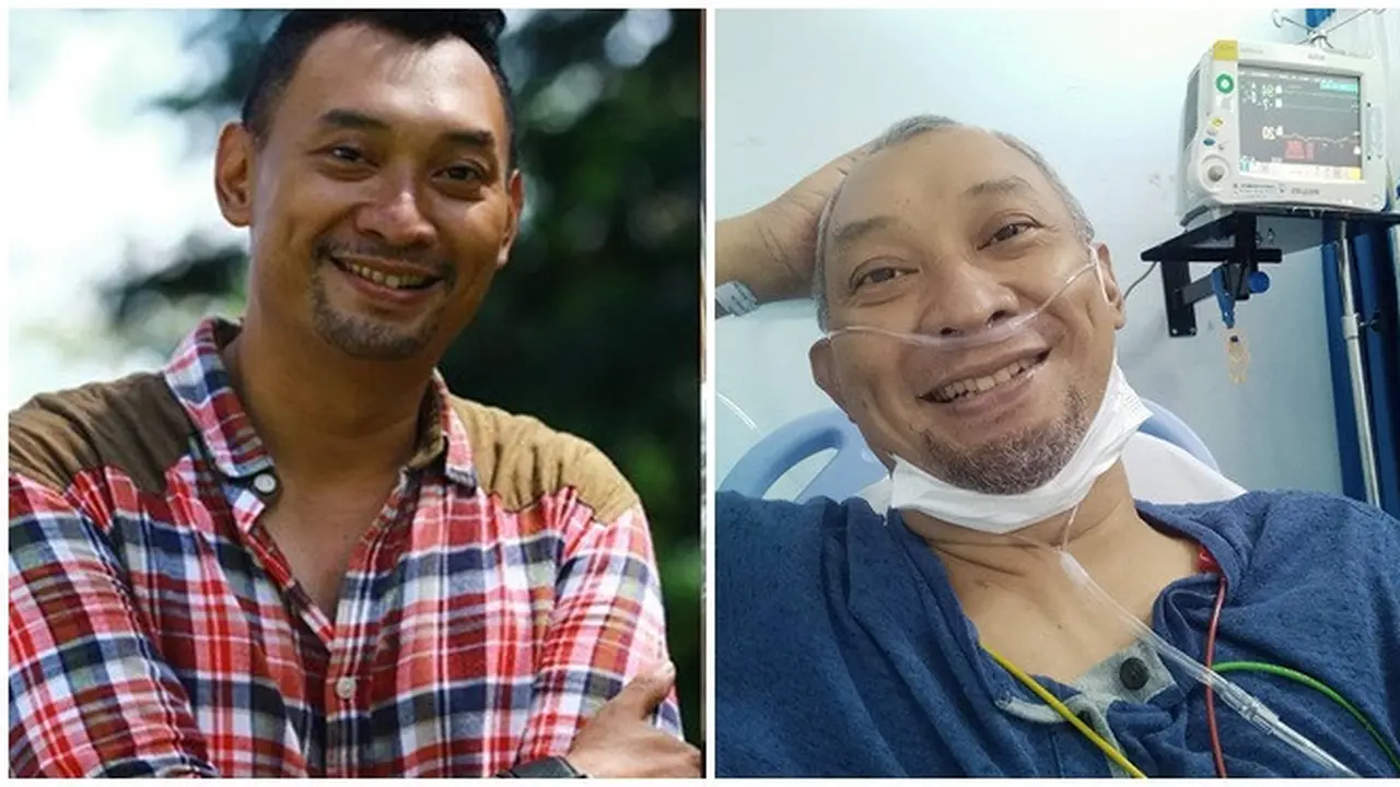 4 Fakta Chef Haryo Pramoe yang Akan Operasi Besar Diseksi Aorta Jantung
