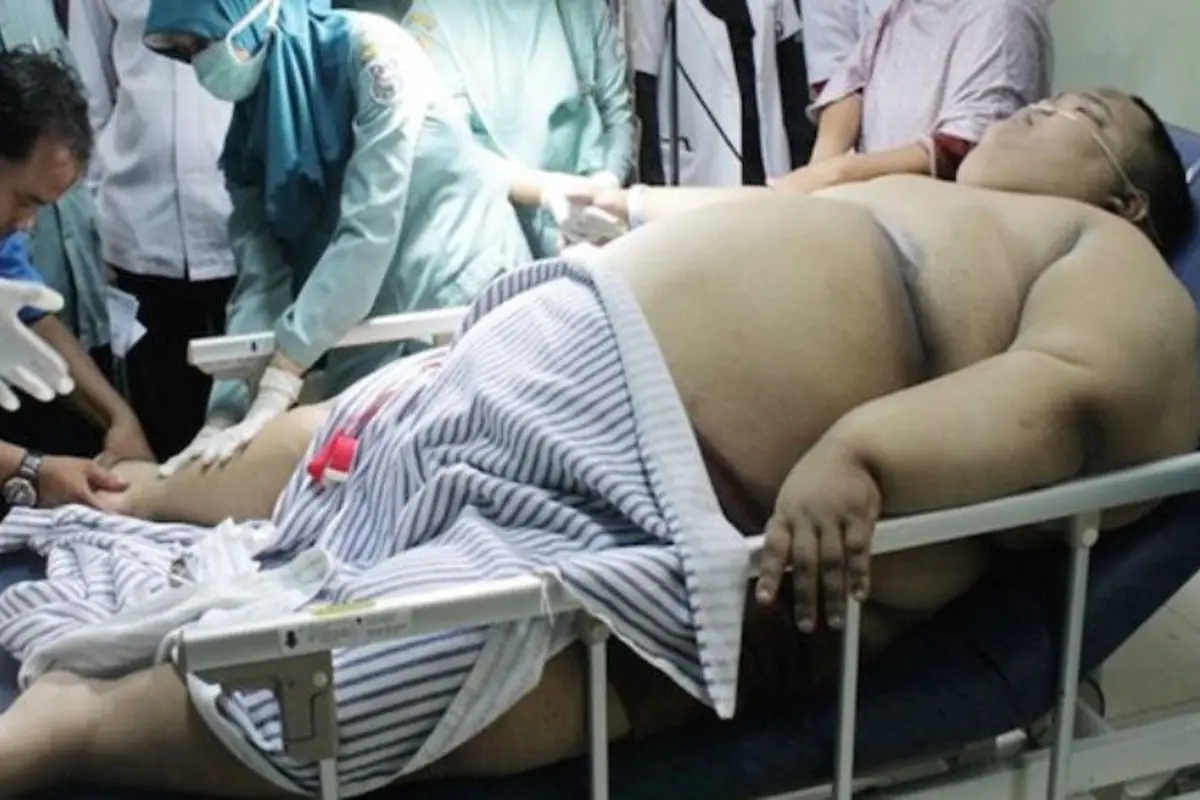Wahid Zaenanda, Bocah 180 Kg Asal Tegal Meninggal Dunia 